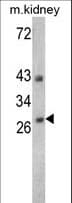 Endonuclease G / ENDOG Antibody (aa188-217)