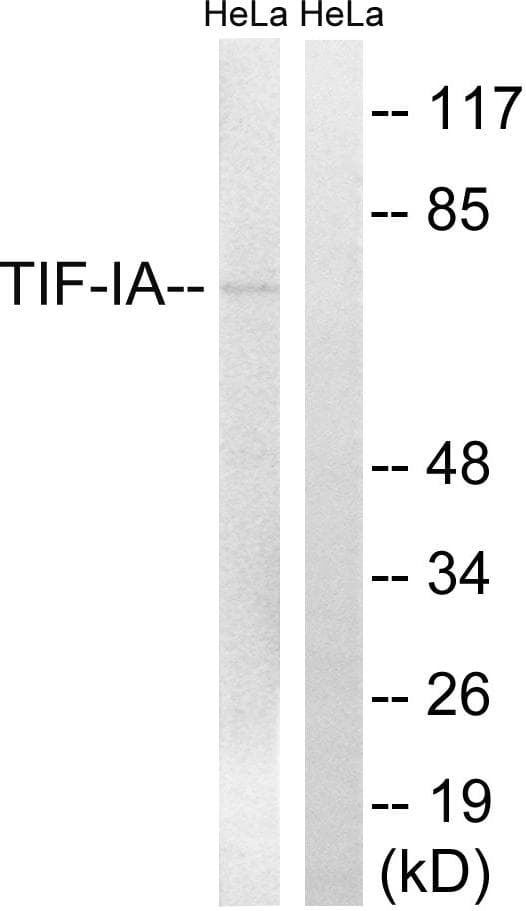 Polyclonal Rabbit anti-Human TIF-IA / RRN3 Antibody (p649, WB)