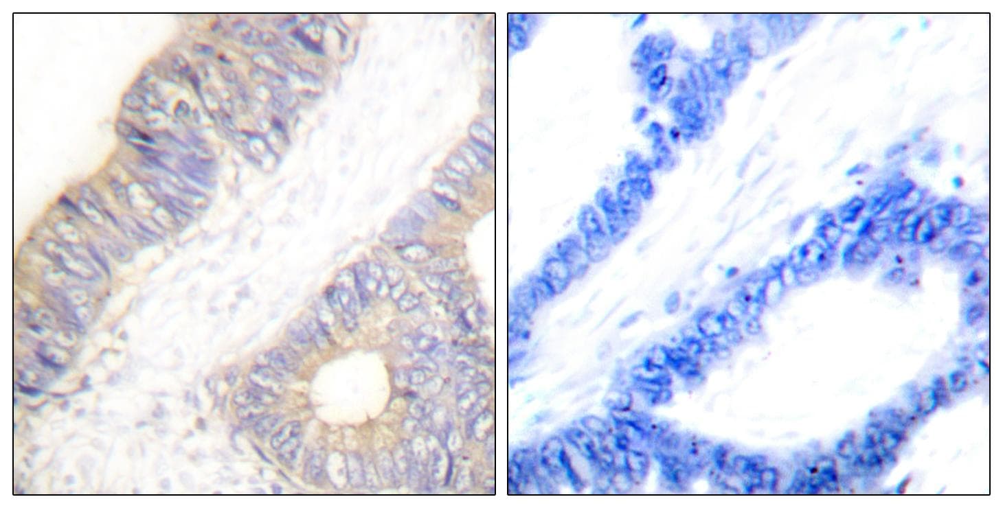 CSTA / Cystatin A Antibody