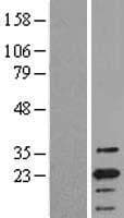 PYCARD / ASC / TMS1 Protein (Over-Expression Lysate Myc-DDK (Flag))