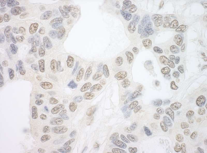 Polyclonal Rabbit anti-Human PRPF6 / TOM Antibody (aa150-200, IHC, WB)
