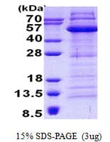 Human TDP2 / TTRAP Protein (Recombinant His)