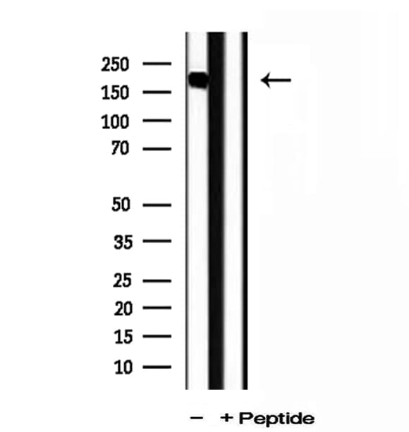 PPFIA1 / LIPRIN Antibody