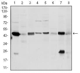 IHC-plus™ Monoclonal Mouse anti-Human ASS1 / ASS Antibody (clone 2C10, IHC, WB)