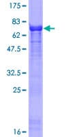 Human SERTAD2 Protein (Recombinant GST)