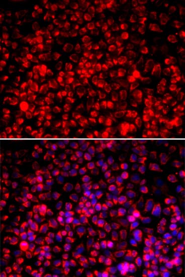 IHC-plus™ Polyclonal Rabbit anti-Human TOMM20 Antibody (IHC, IF, WB)