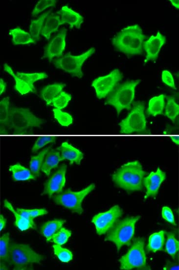 Polyclonal Rabbit anti-Human HSPB1 / HSP27 Antibody (IHC, IF, WB)