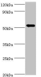 CAMK1G / CaMKI gamma Antibody (aa217-476)