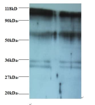 PHGDH Antibody
