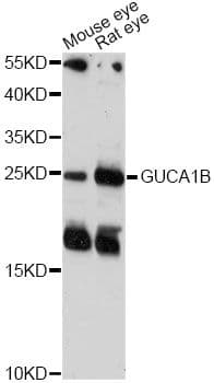 GCAP2 / GUCA1B Antibody
