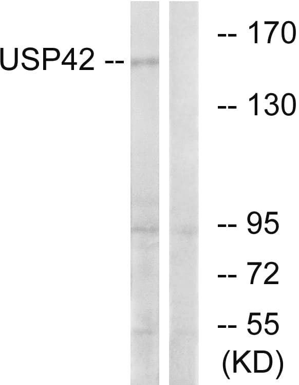 IHC-plus™ Polyclonal Rabbit anti-Human USP42 Antibody (aa251-300, IHC, WB)
