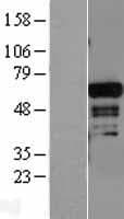 ADAM28 Protein (Over-Expression Lysate Myc-DDK (Flag))