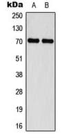 NF2 / Merlin Antibody (phospho-Ser518)