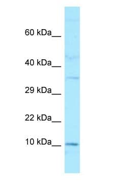 GAGE2A Antibody (C-Terminus)