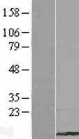 TMSB15B Protein (Over-Expression Lysate Myc-DDK (Flag))