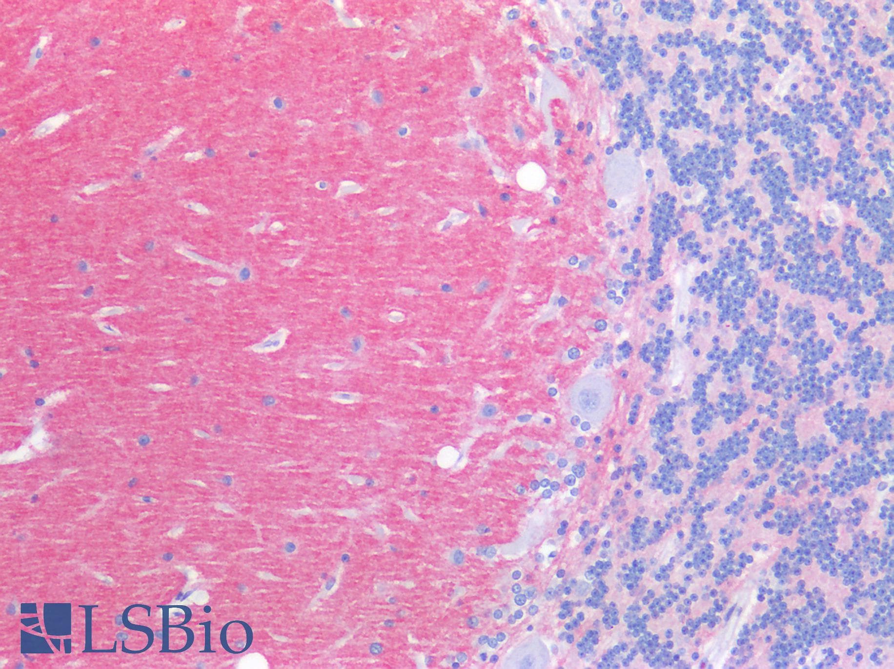 PathPlus™ CNTN1 / gp135 / Contactin 1 Antibody