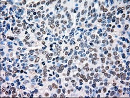 BRAF / B-Raf Antibody (clone OTI3A7)