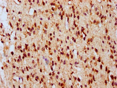 ATG16L2 Antibody