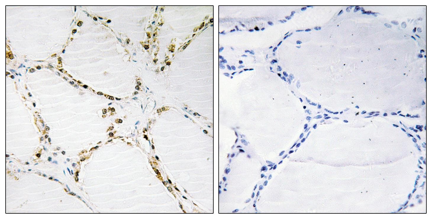 Polyclonal Rabbit anti-Human FOXO1 / FKHR Antibody (IHC, WB)