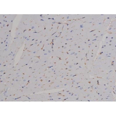 STAT6 Antibody (phospho-Thr645)