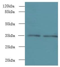 Polyclonal Rabbit anti-Human NAIF1 Antibody (IHC, WB)