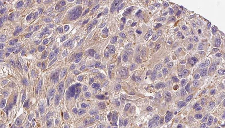 Polyclonal Rabbit anti-Human COL4A6 / Collagen IV Antibody (IHC, WB)
