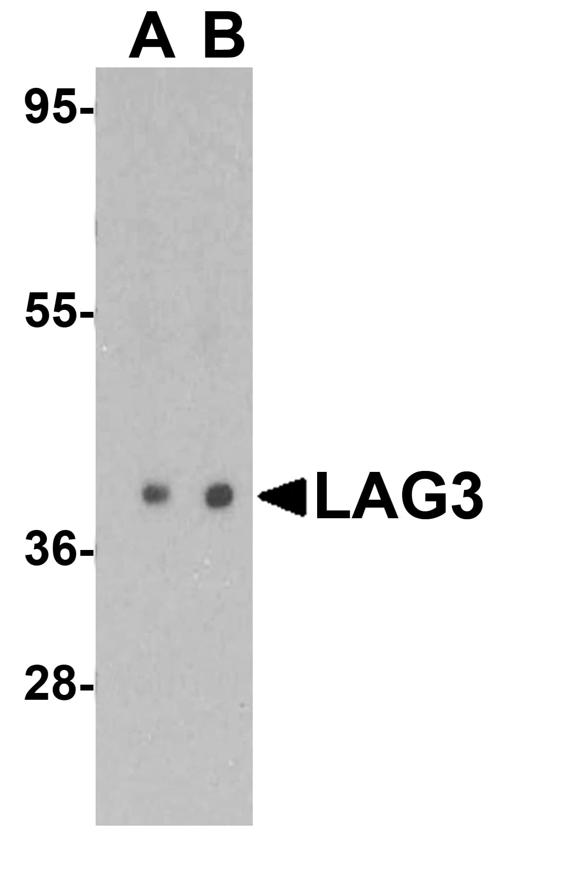Polyclonal Rabbit anti-Human LAG3 Antibody (IHC, IF, WB)