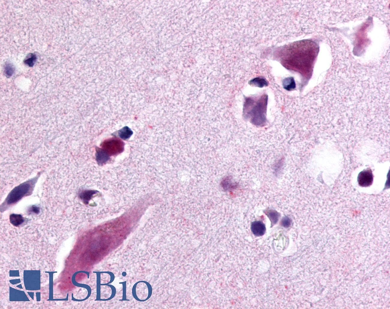 IHC-plus™ Polyclonal Rabbit anti-Human C5AR2 / GPR77 / C5L2 Antibody (N-Terminus, IHC)