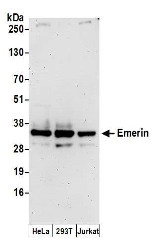 EMD / Emerin Antibody (aa1-50)