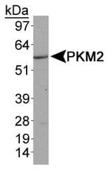 PKM / Pyruvate Kinase, Muscle Antibody (aa350-450)