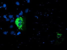 PDSS2 / DLP1 Antibody (clone OTI4F9)