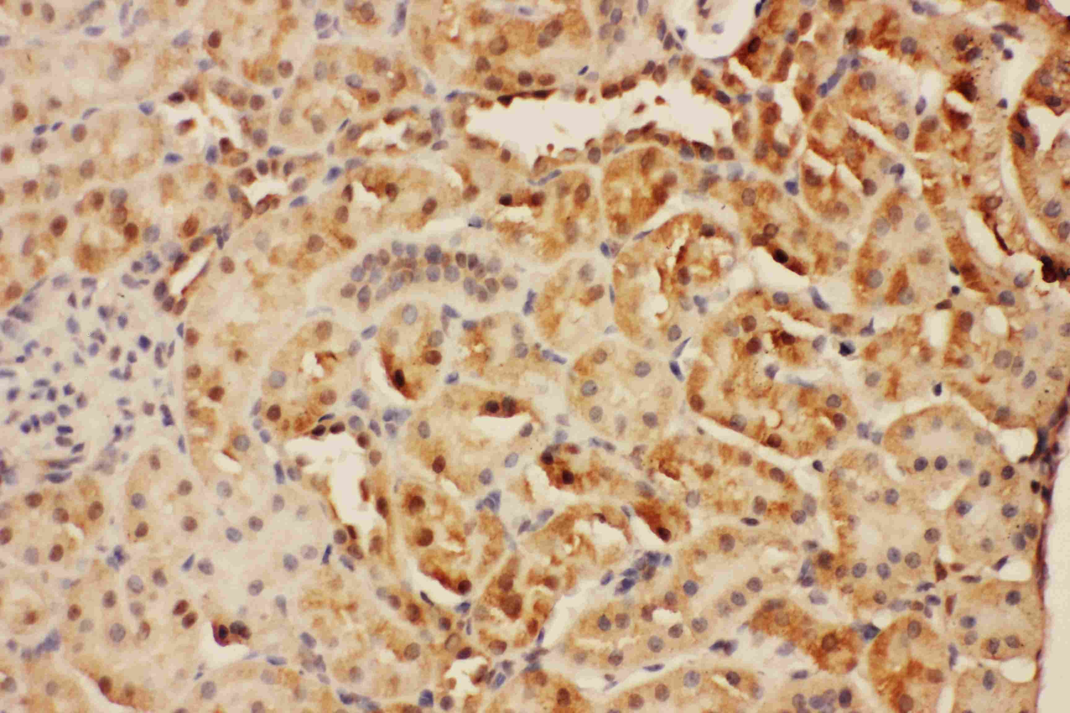 CISH / SOCS Antibody (aa241-258)