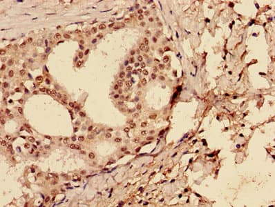 Polyclonal Rabbit anti-Human TP53 / p53 Antibody (aa2-393, IHC, WB)
