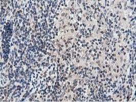 Dipeptidyl Peptidase 3 / DPP3 Antibody (clone OTI2D9)