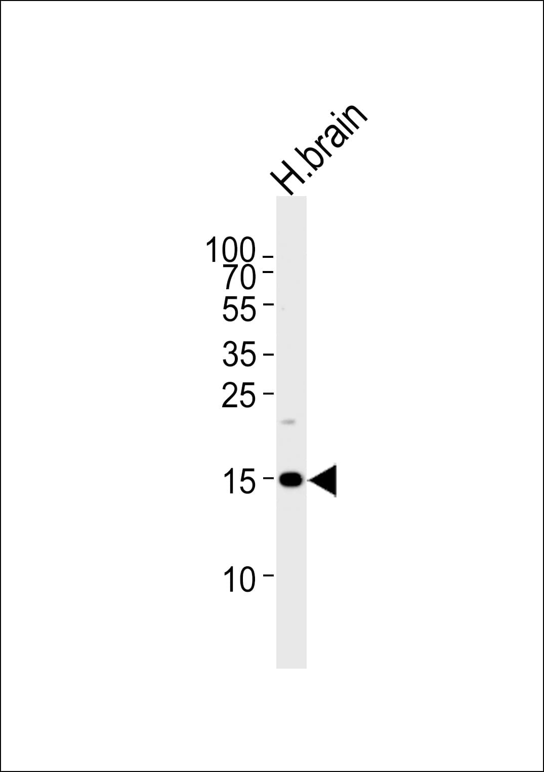 Polyclonal Rabbit anti-Human SPRN / SHADOO Antibody (aa76-105, IHC, WB)