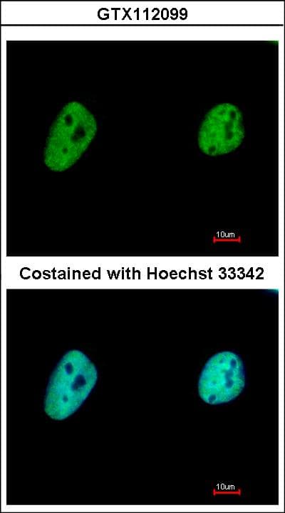 TCERG1 / CA150 Antibody