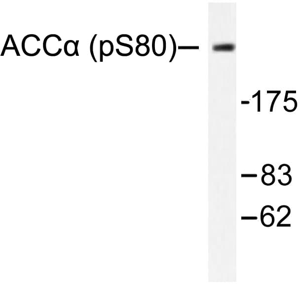Polyclonal Rabbit anti-Human Acetyl-CoA Carboxylase / ACC Antibody (phospho-Ser80, IHC, WB)