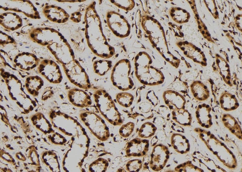 MAPK1 / ERK2 Antibody