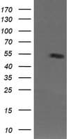IHC-plus™ MDM4 / MDMX Antibody (clone 4G3)