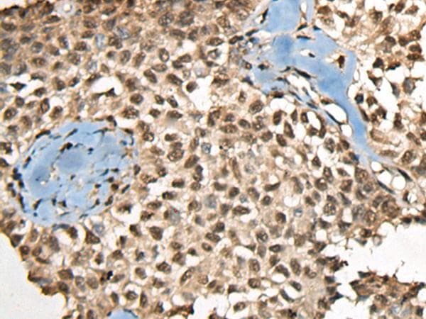 CCDC12 Antibody