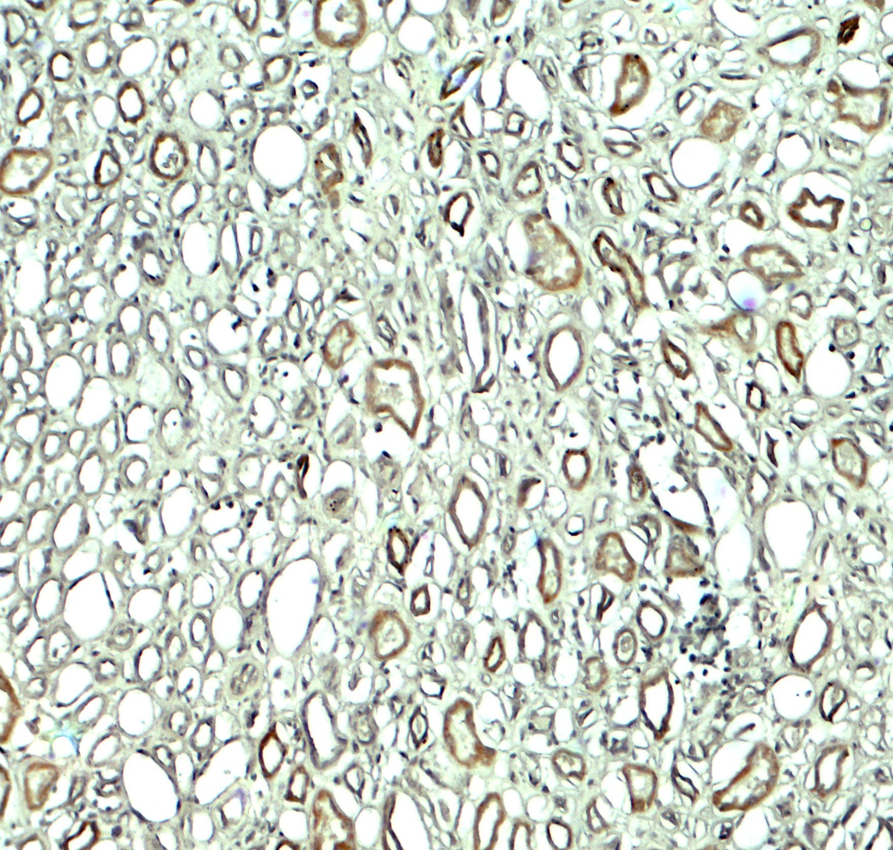 KIAA0226 / RUBICON Antibody