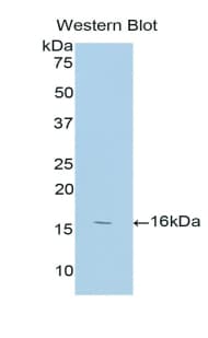 ANXA3 / Annexin A3 Antibody (aa190-312)