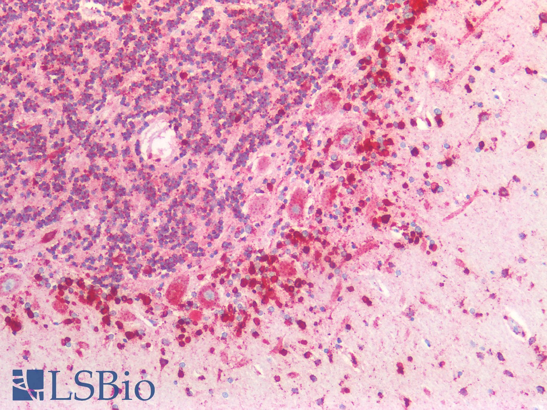 PathPlus™ CTSD / Cathepsin D Antibody (Internal)