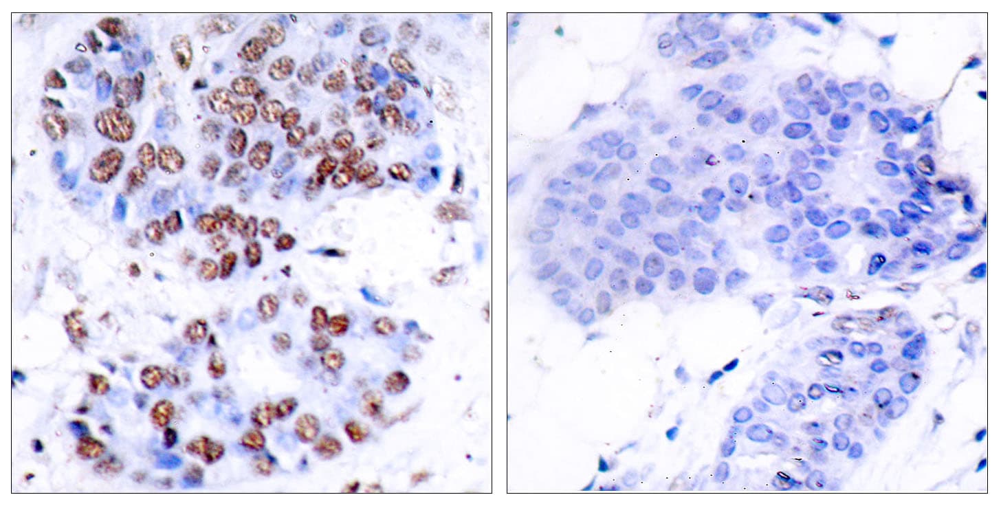 RELA / NFKB p65 Antibody (aa249-298)