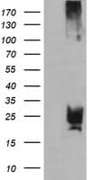 Monoclonal Mouse anti-Human CMPK / CMPK1 Antibody (clone OTI2B2, IHC, IF, WB)