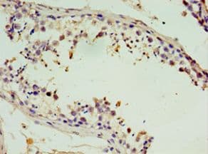 STX11 / Syntaxin 11 Antibody (aa1-287)