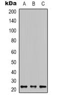 KRAS Antibody (C-Terminus)