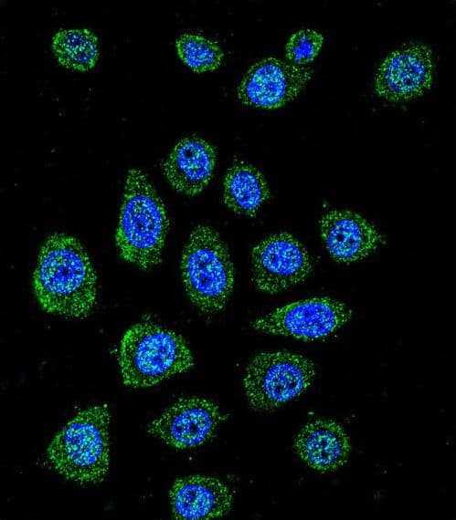 Polyclonal Rabbit anti-Human PABPN1L Antibody (aa166-194, IHC, IF, WB)