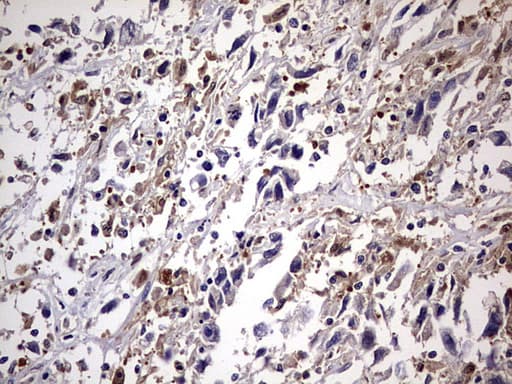 KYNU Antibody (aa1-216, clone OTI1H1)