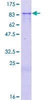 Human ZNF613 Protein (Recombinant GST)